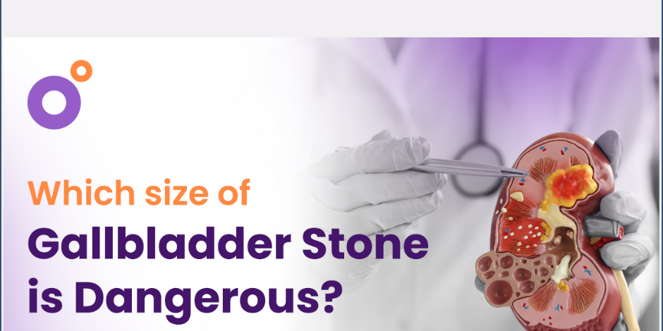 What Size Of GallBladder Stones Need Surgery?