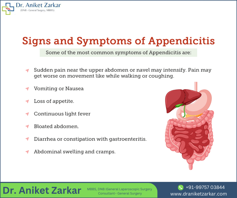 Appendicitis Common Signs Diagnosis And Treatment