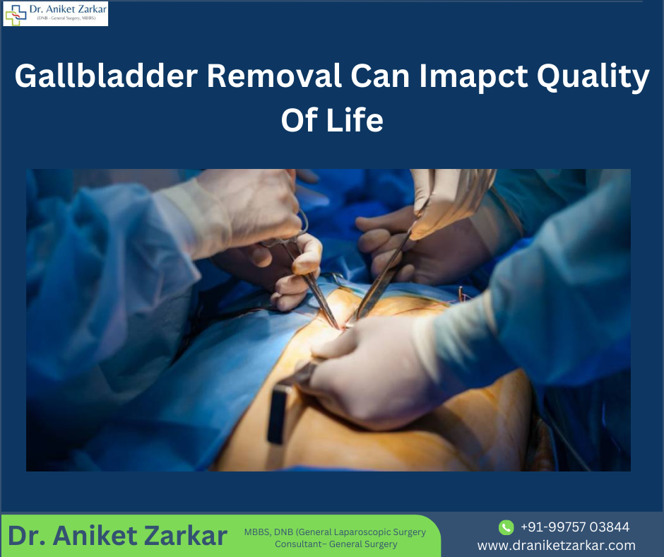 Gallbladder Removal Can Imapct The Quality Quality Life.